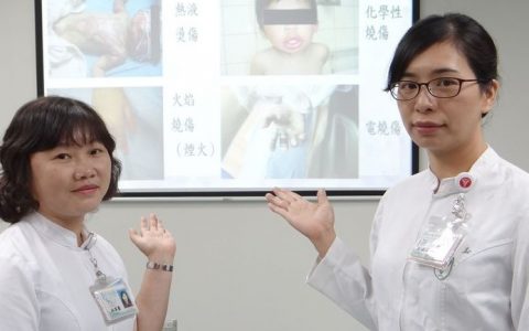 儿童烧烫伤八成五在家发生 家长要注意这些