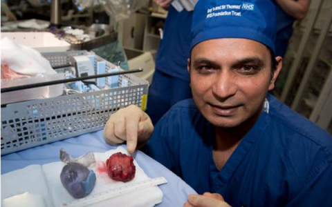 3D打印技术未来手术计划的新手段。