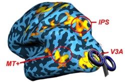 经颅脑磁刺激实验结果