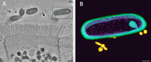 Bacteroides fragilis and intestinal epithelial cells shown as an overview tomogram with the modeled bacterium indicated with a black box (left, fig. A). The model reveals secretion of outer membrane vesicles (right, fig. B), bacterial structures discovered to interact with the immune system via genetic pathways linked to Crohn’s disease. Green, outer membrane; light blue, inner membrane; pink, ribosomes; gold; outer membrane vesicles. Credit: Mark Ladinsky/Greg Donaldson/Caltech 