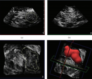 QQ图片20160604143246