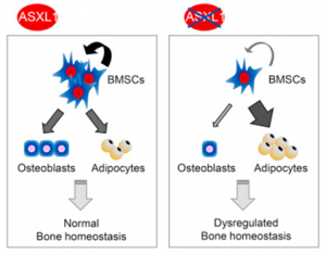 Bohring-Opitz综合征胚系突变基因ASXL1在骨髓基质多能祖细胞功能和骨骼发育维持中起关键作用 