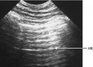 db8ce057gw1erd1tnipuqj20bs09et9g