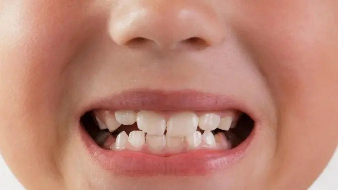 child-big-smile-showing-teeth