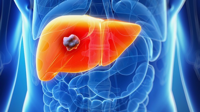 dt_150326_liver_cancer_800x600