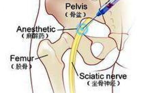 臂丛麻醉后呼吸停止