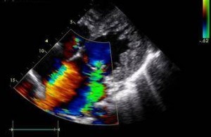 u=4241251982,367945438&fm=21&gp=0