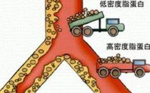 CJASN：“好胆固醇”更可能会增加早逝风险