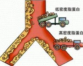 CJASN:“好胆固醇”更可能会增加早逝风险0