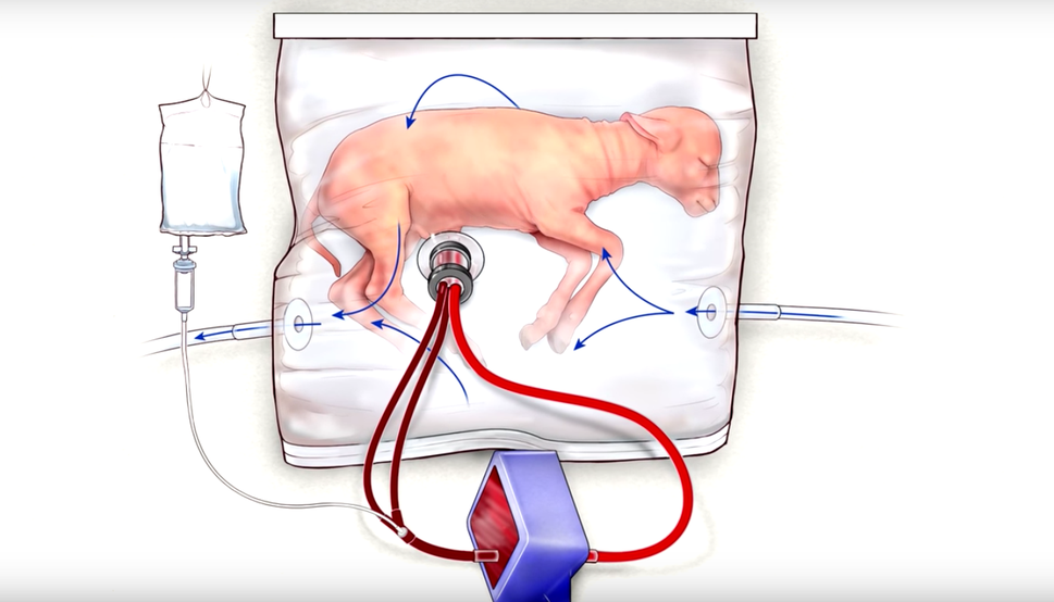 artificial-womb