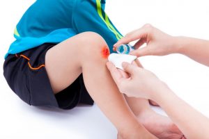 在家里,实用的8种快速有效的止血方法