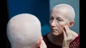 癌症化疗后的病人为什么会掉头发？
