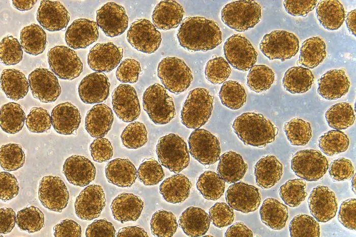 显微镜下可以产生人类胰岛素的β细胞