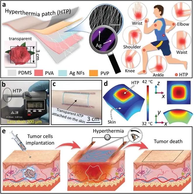 可穿戴型柔性透明热疗片显著抑制皮下肿瘤生长