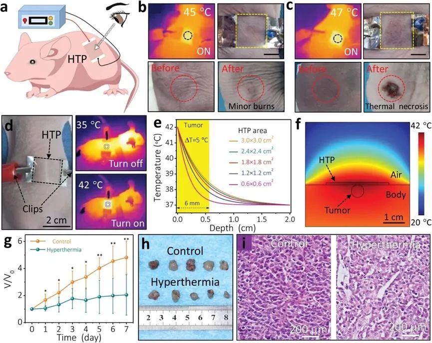 可穿戴型柔性透明热疗片显著抑制皮下肿瘤生长