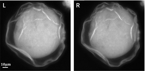 花粉样品的左右视角荧光图像