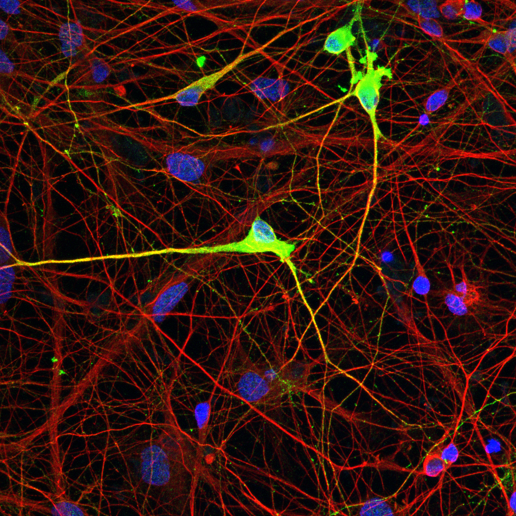 基因编辑有望治疗遗传病